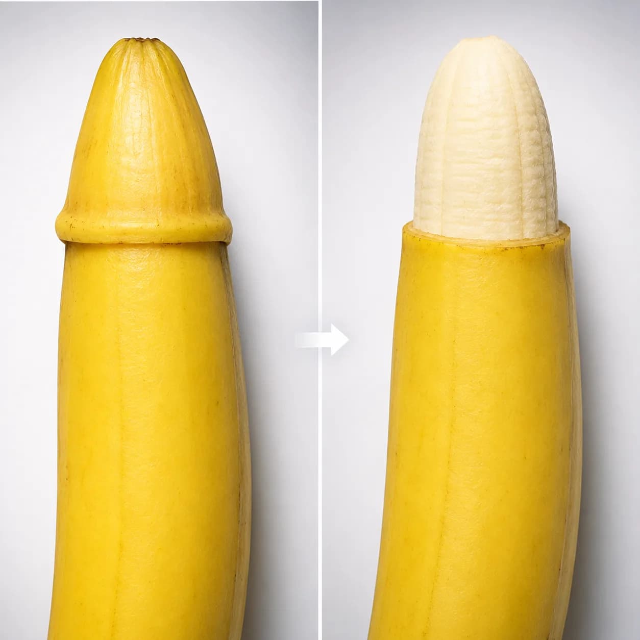 Circumcision